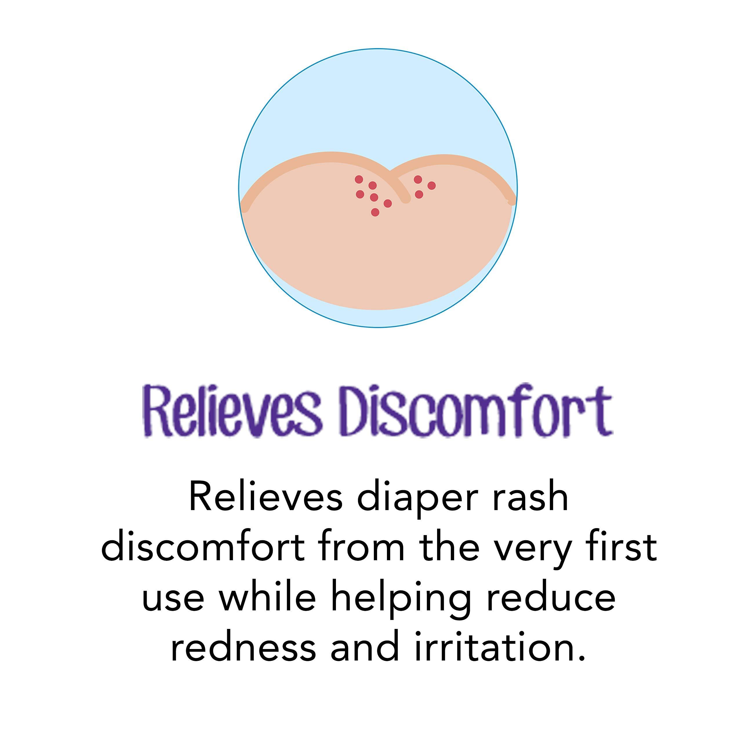 Desitin Desitin Daily Defense Baby Diaper Rash Cream with Zinc Oxide to Treat, Relieve & Prevent diaper rash, Hypoallergenic, Dye-, Phthalate- & Paraben-Free, 16 oz
