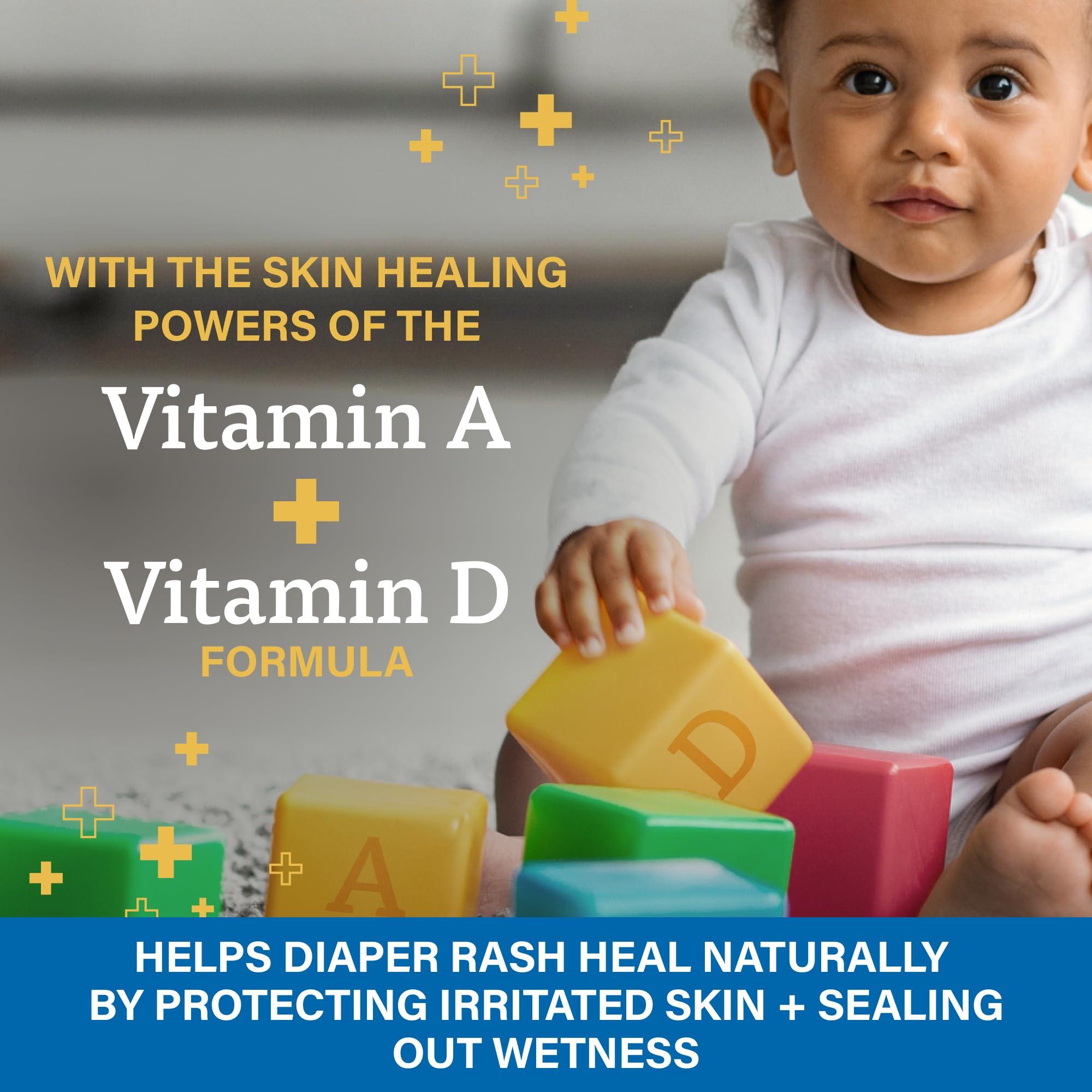 A+D A+D Zinc Oxide Diaper Rash Cream - Soothes & Treats Diaper Rash - Zinc Oxide 10% Dimethicone 1% - Easy Spreading Cream for Baby - Healing Skin Ointment for Red, Irritated Skin - 4oz, 2 Pack