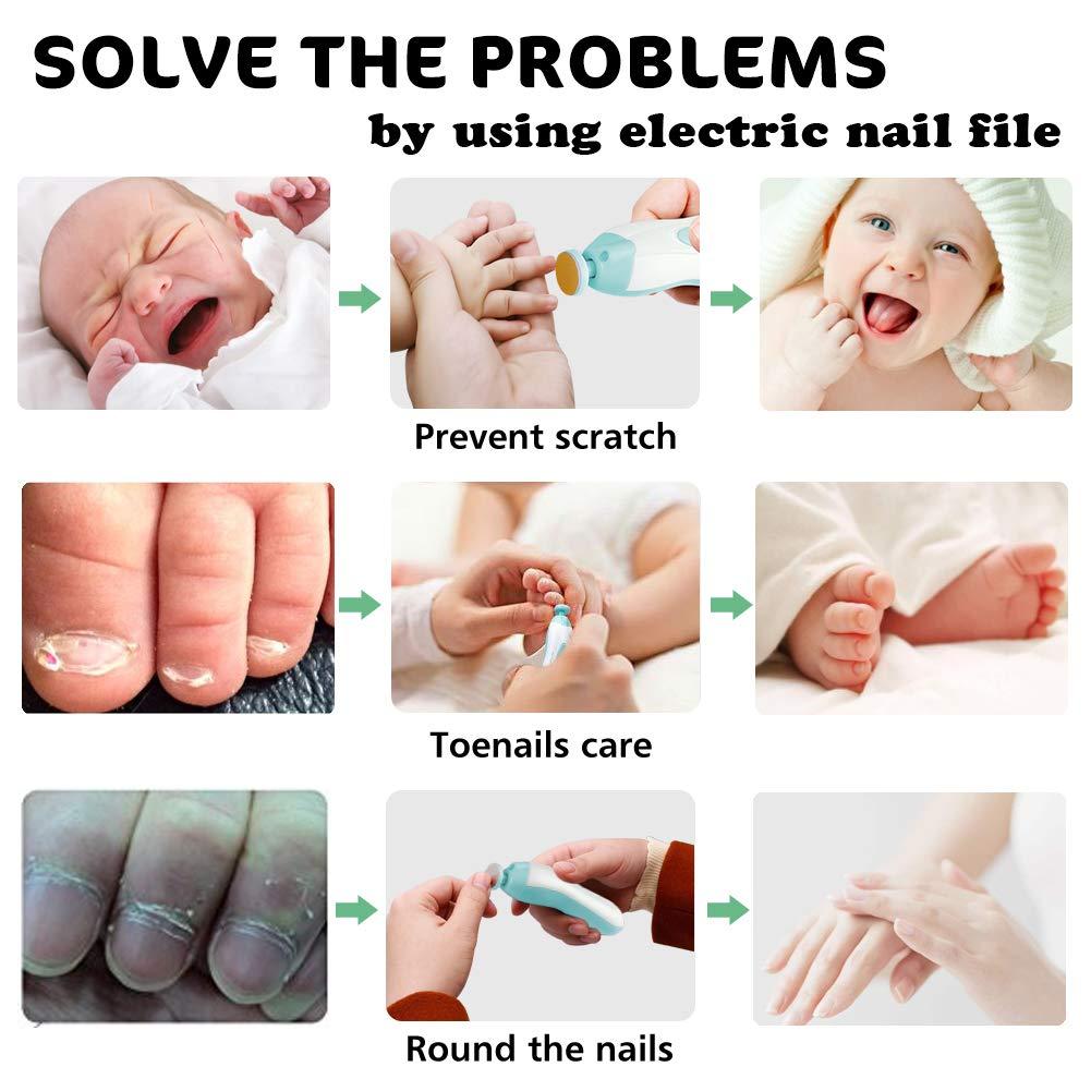 Consevisen Baby Nail Trimmer Electric Nail File Baby Nail Clippers, 20 in 1 Safe Nail Filer Grinder Kit for Newborn Infant Toddler Kids or Adults Toes Fingernails Care Trim Polish, Led Light and Grinding Heads