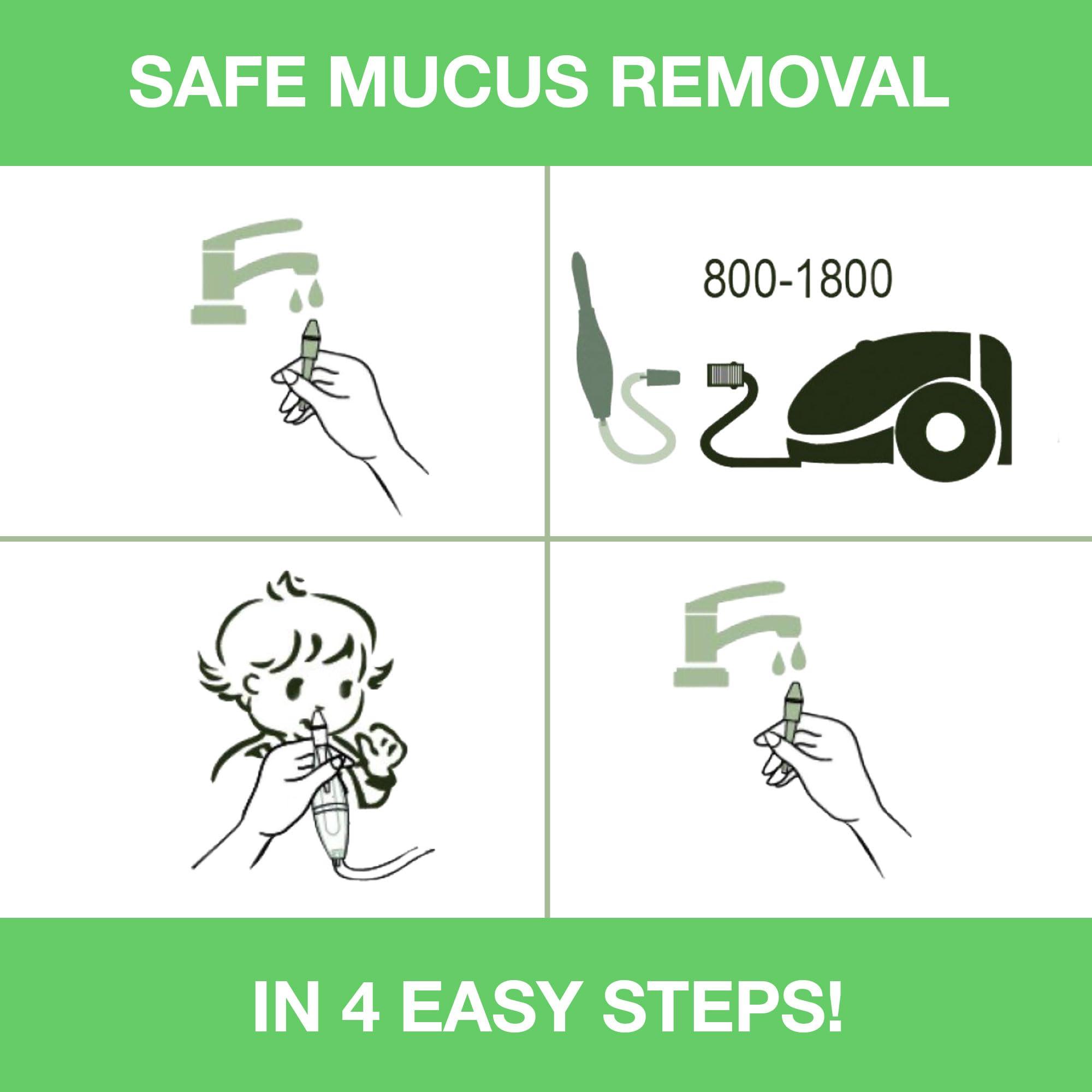 BABY-VAC BABY-VAC Clinically Tested Baby Nasal Aspirator - Vacuum-Powered Nose Sucker with Suction Head & Cleaning Brush for Safe and Gentle Relief